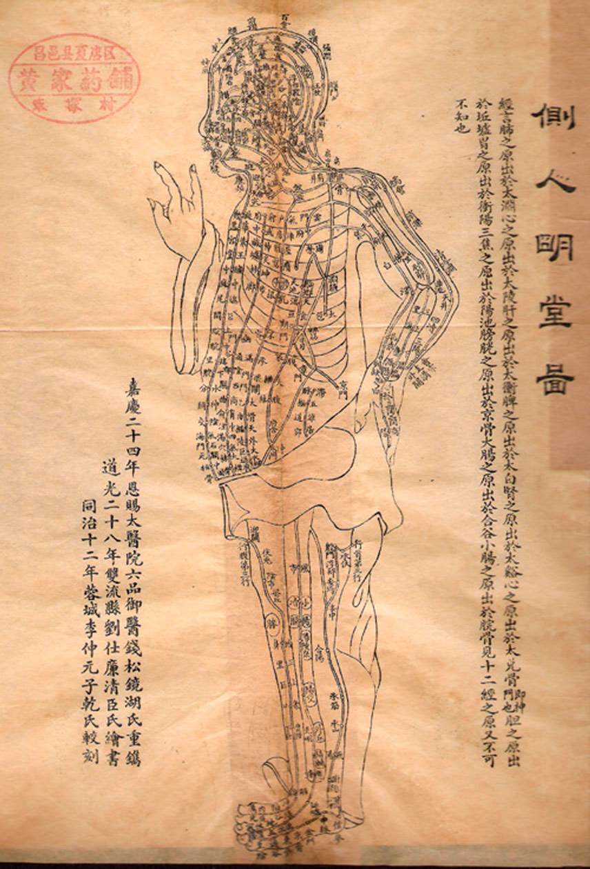 ¿Qué es la Acupuntura?